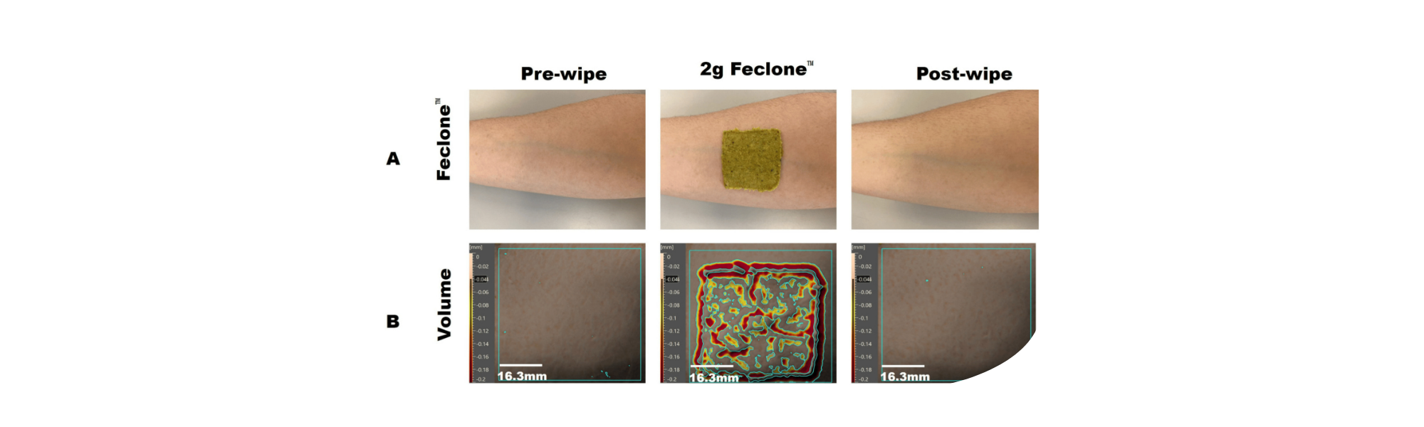An Alternative Approach to Validate the Cleaning Efficiency of a Skin Cleansing Wipe